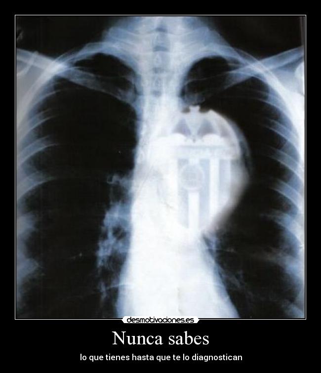 Nunca sabes - lo que tienes hasta que te lo diagnostican