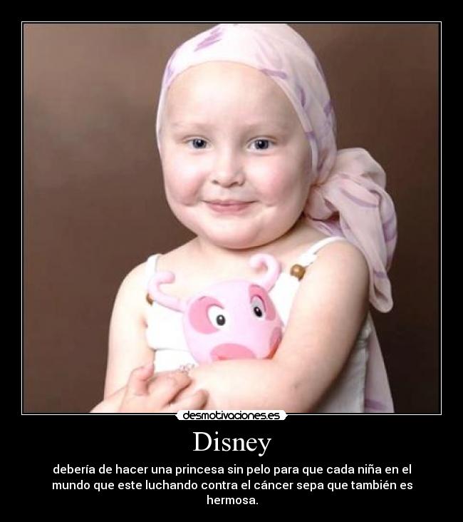 Disney - debería de hacer una princesa sin pelo para que cada niña en el
mundo que este luchando contra el cáncer sepa que también es
hermosa.