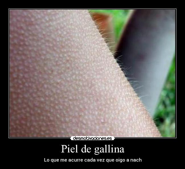 Piel de gallina - Lo que me acurre cada vez que oigo a nach