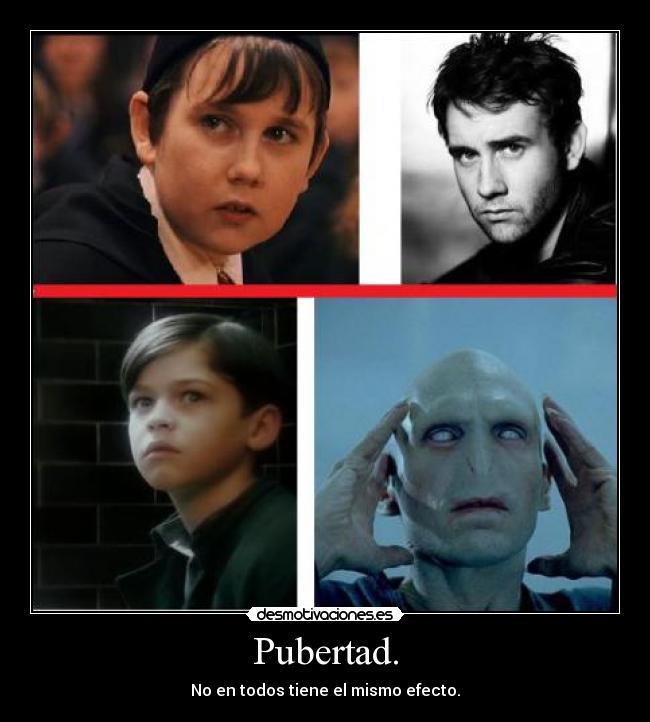 Pubertad. -
