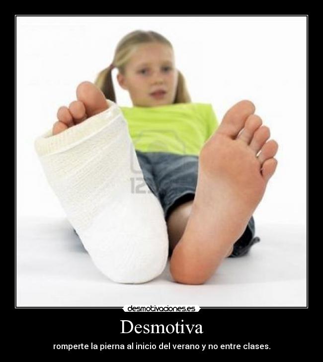 Desmotiva - romperte la pierna al inicio del verano y no entre clases.