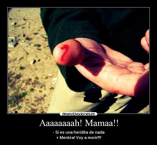 Aaaaaaaah! Mamaa!! - - Si es una heridita de nada
+ Mentira! Voy a morir!!!!