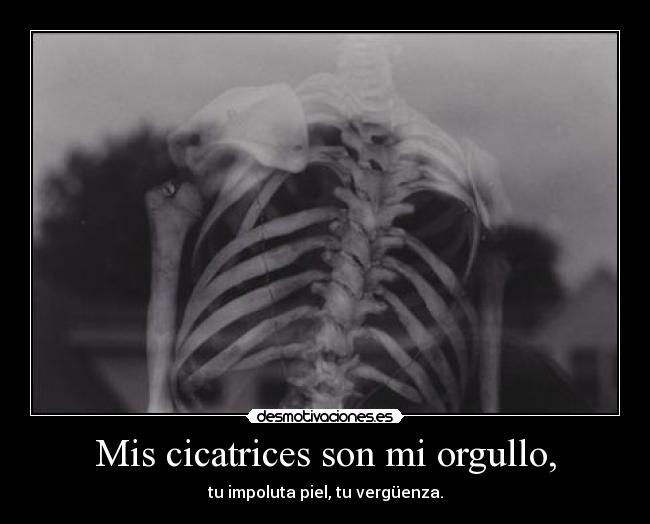Mis cicatrices son mi orgullo, -