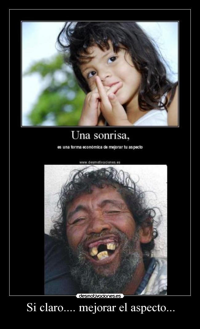 Si claro.... mejorar el aspecto... -