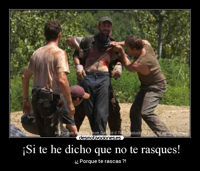 ¡Si te he dicho que no te rasques! - ¡¿ Porque te rascas ?!