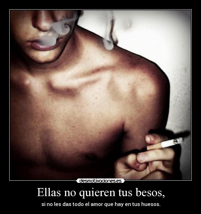Ellas no quieren tus besos, - 