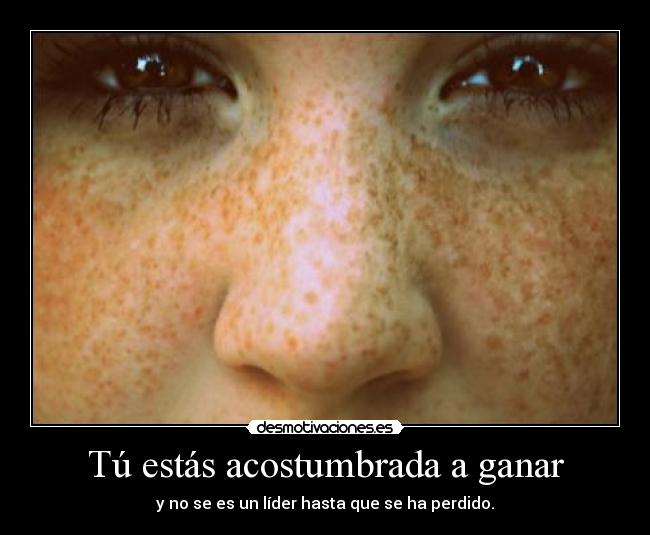 Tú estás acostumbrada a ganar -