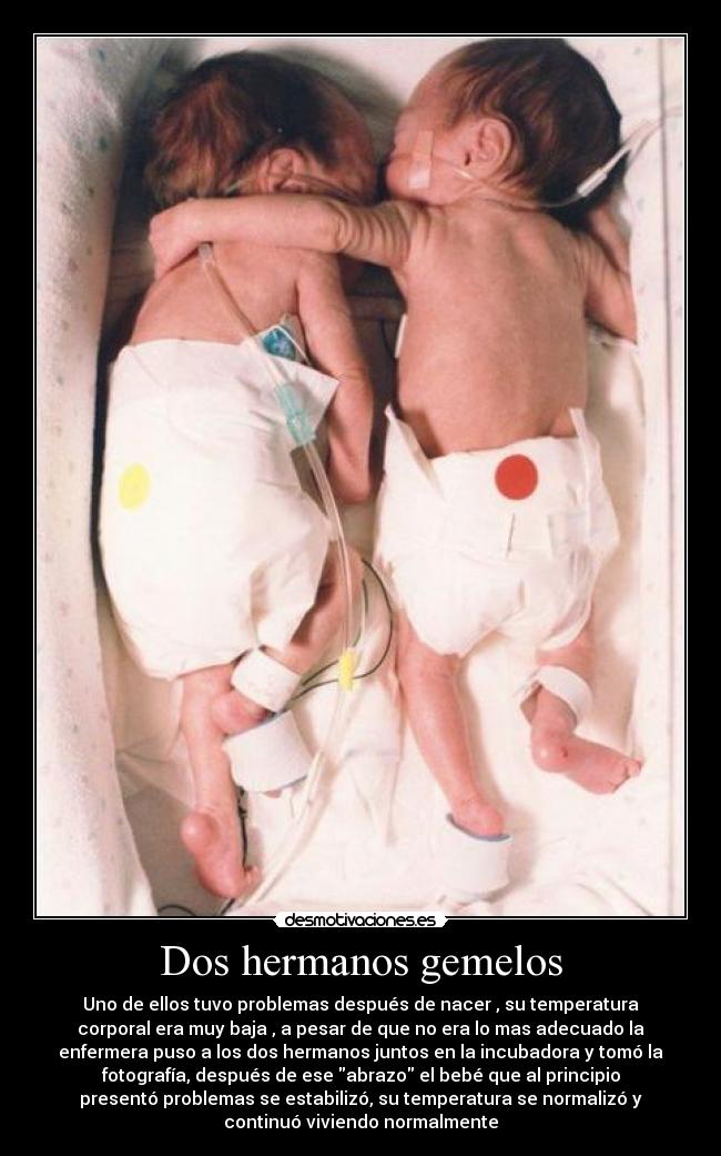 Dos hermanos gemelos - Uno de ellos tuvo problemas después de nacer , su temperatura
corporal era muy baja , a pesar de que no era lo mas adecuado la
enfermera puso a los dos hermanos juntos en la incubadora y tomó la
fotografía, después de ese abrazo el bebé que al principio
presentó problemas se estabilizó, su temperatura se normalizó y
continuó viviendo normalmente