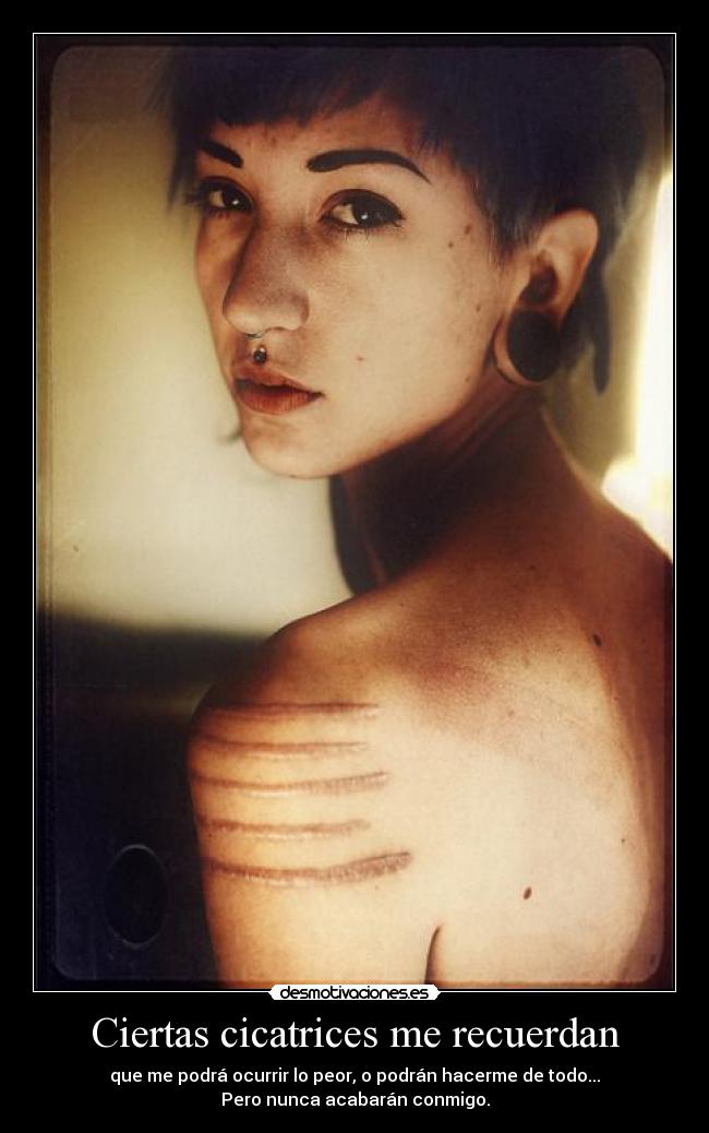 Ciertas cicatrices me recuerdan - que me podrá ocurrir lo peor, o podrán hacerme de todo...
Pero nunca acabarán conmigo.