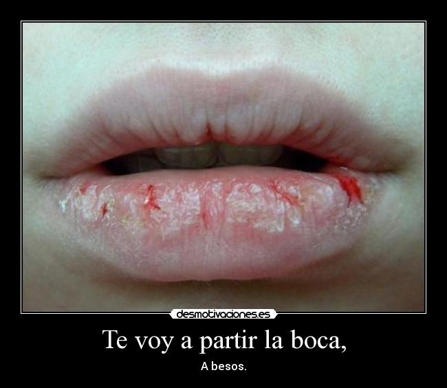 Te voy a partir la boca, - A besos.