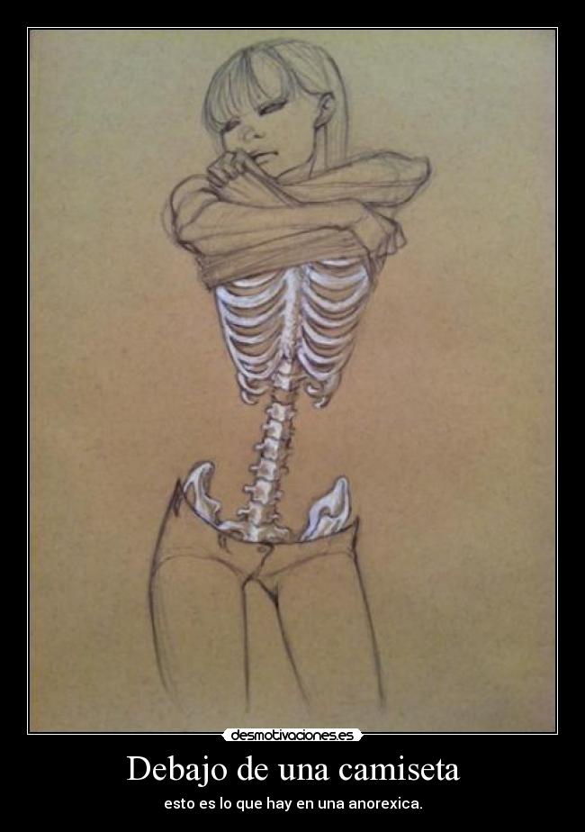 Debajo de una camiseta - esto es lo que hay en una anorexica.