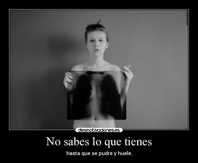 No sabes lo que tienes - 