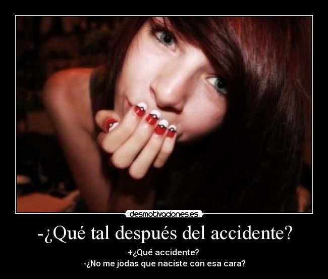 -¿Qué tal después del accidente? - +¿Qué accidente? 
-¿No me jodas que naciste con esa cara?