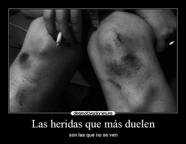 Las heridas que más duelen -