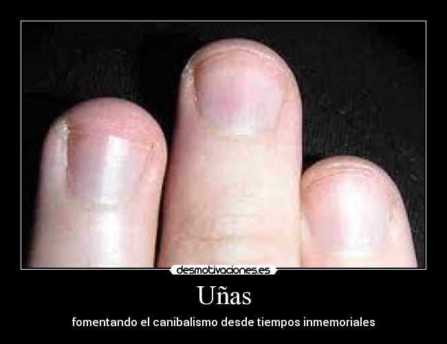 Uñas -