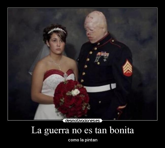 La guerra no es tan bonita -