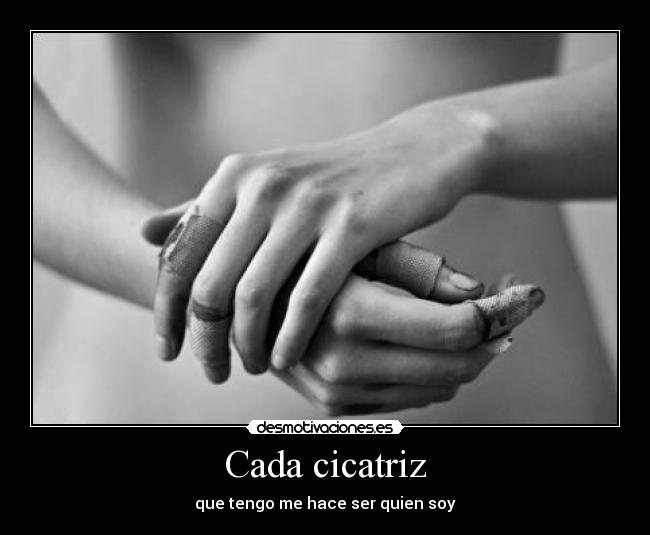 Cada cicatriz - que tengo me hace ser quien soy