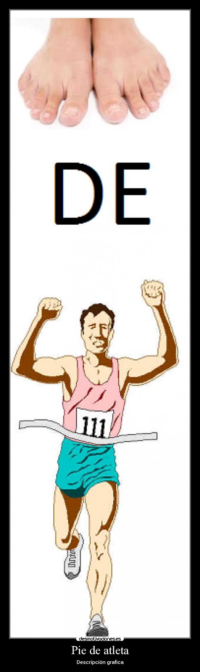 Pie de atleta -