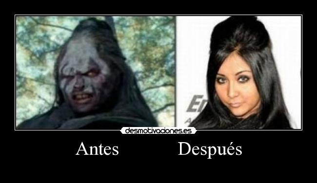Antes            Después - 