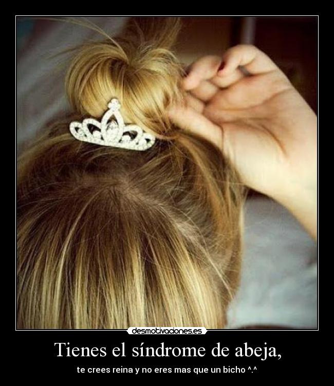 Tienes el síndrome de abeja, -