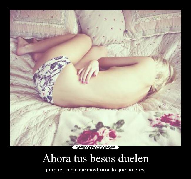 Ahora tus besos duelen - 