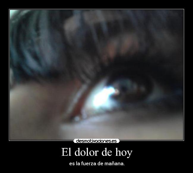 El dolor de hoy -