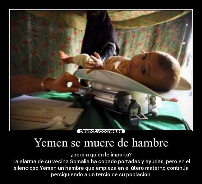 Yemen se muere de hambre - ¿pero a quién le importa?
La alarma de su vecina Somalia ha copado portadas y ayudas, pero en el
silencioso Yemen un hambre que empieza en el útero materno continúa
persiguiendo a un tercio de su población.