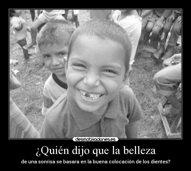 ¿Quién dijo que la belleza - de una sonrisa se basara en la buena colocación de los dientes?