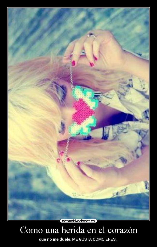 Como una herida en el corazón - que no me duele, ME GUSTA COMO ERES.. ♥