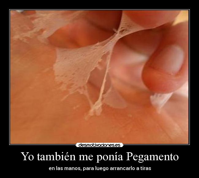 Yo también me ponía Pegamento -