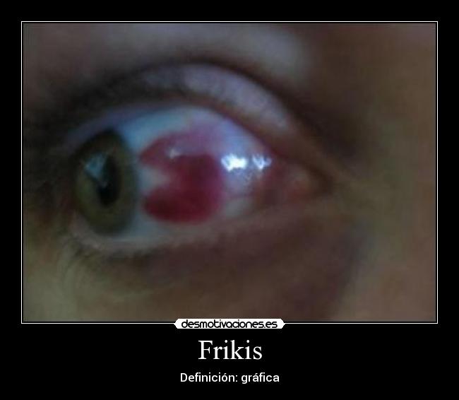 Frikis - Definición: gráfica