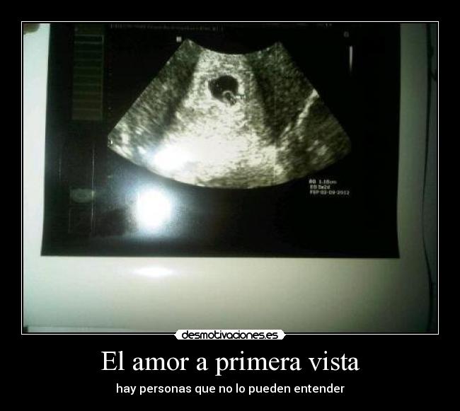 El amor a primera vista - 