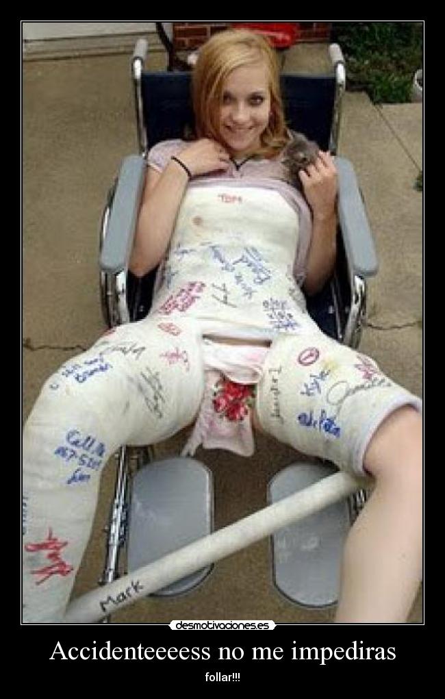 Accidenteeeess no me impediras - follar!!!