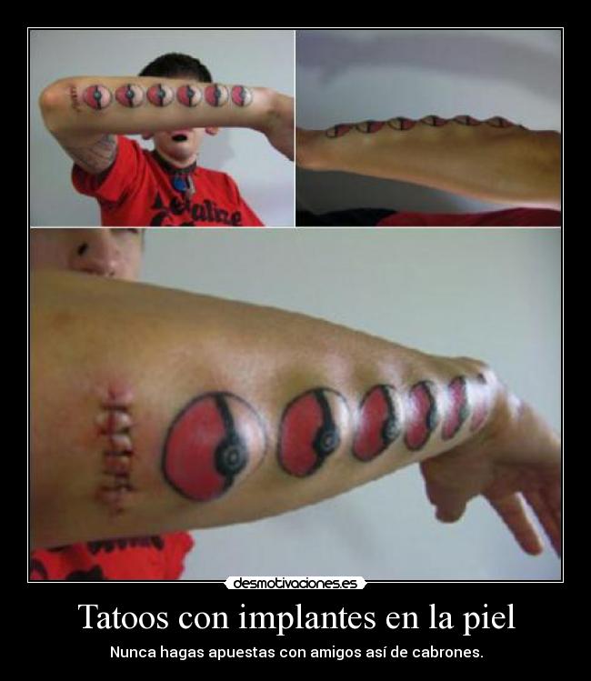 Tatoos con implantes en la piel - 