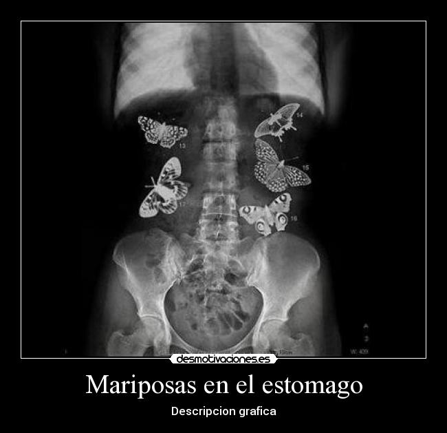 Mariposas en el estomago - Descripcion grafica