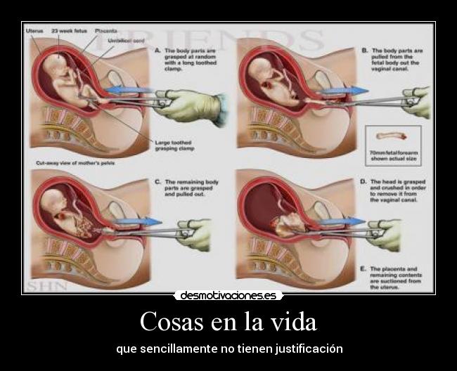 Cosas en la vida - 