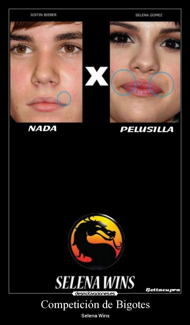 Competición de Bigotes - Selena Wins