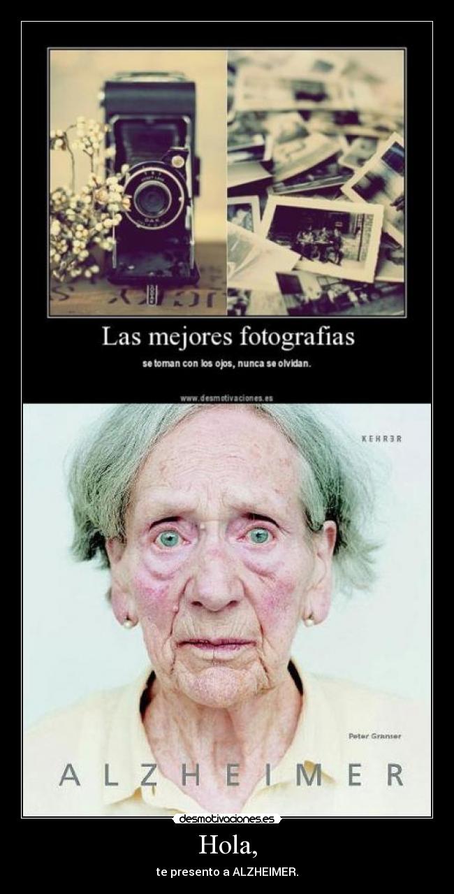 Hola, - te presento a ALZHEIMER.