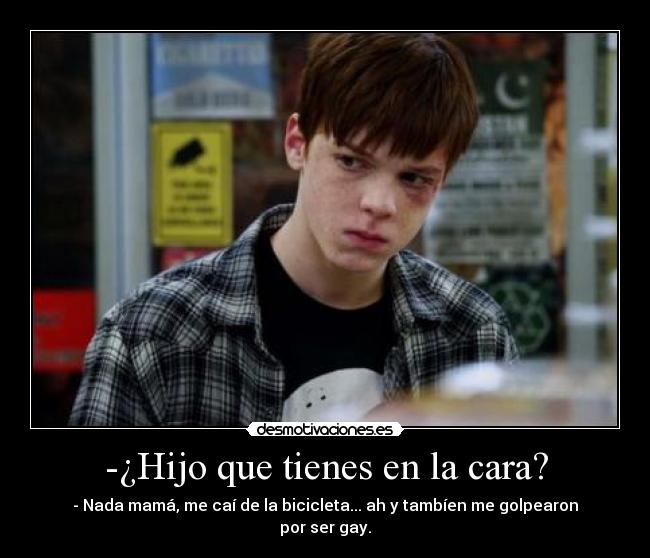 -¿Hijo que tienes en la cara? -