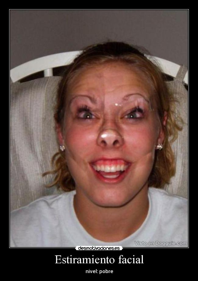 Estiramiento facial -