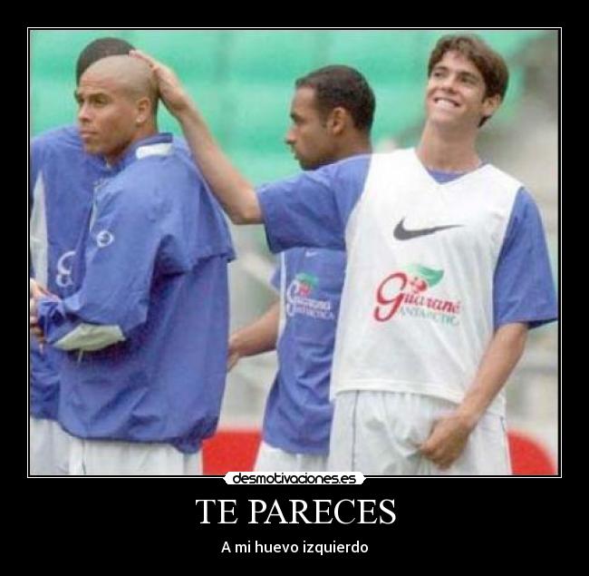 TE PARECES - A mi huevo izquierdo