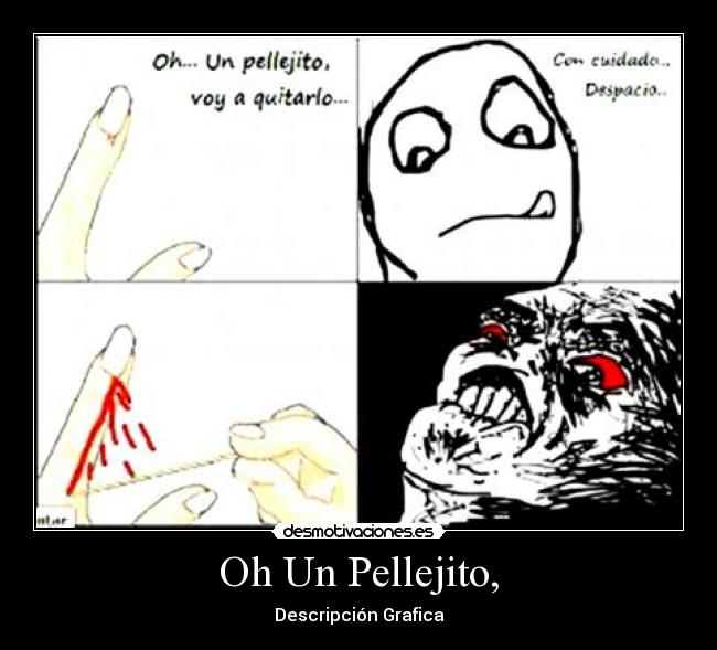 Oh Un Pellejito, -