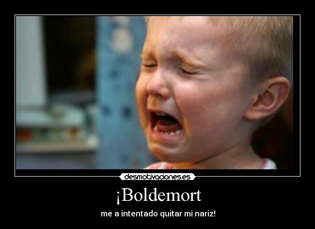 ¡Boldemort -