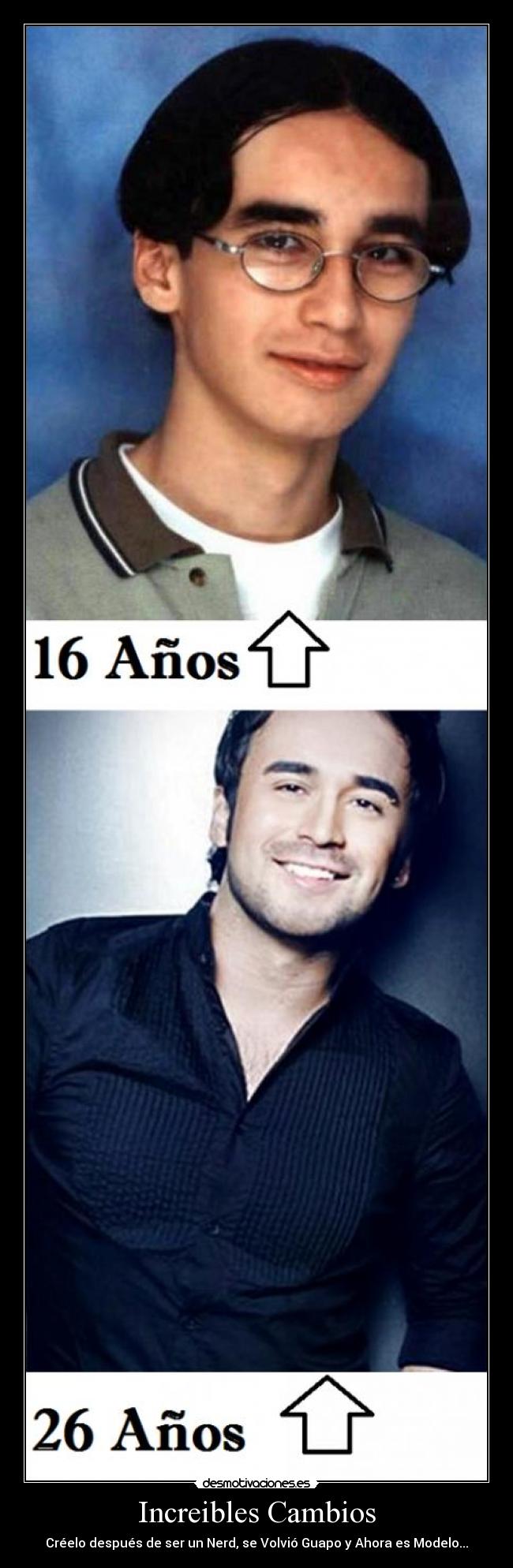 Increibles Cambios - Créelo después de ser un Nerd, se Volvió Guapo y Ahora es Modelo...