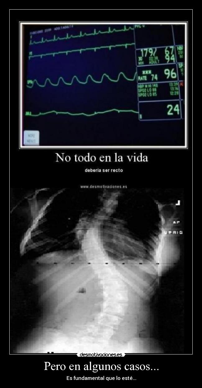 Pero en algunos casos... - 