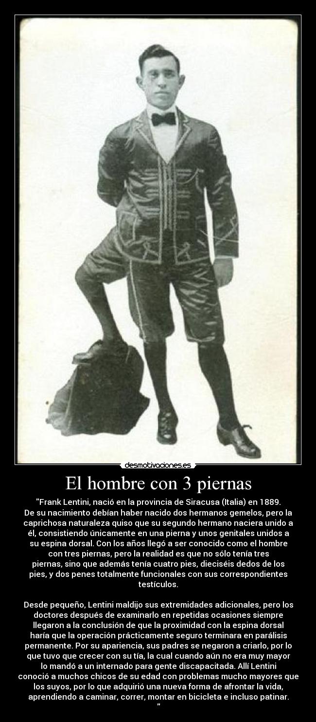 El hombre con 3 piernas - 