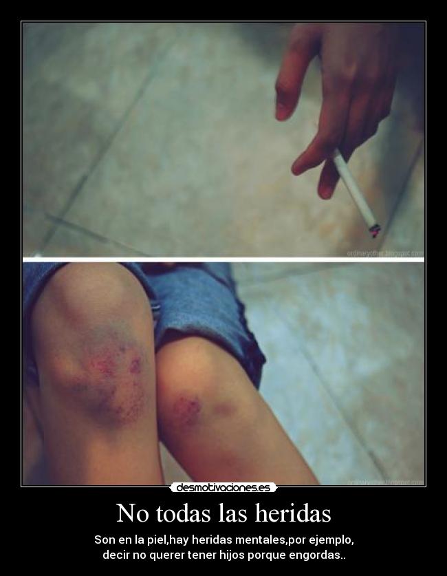 No todas las heridas - Son en la piel,hay heridas mentales,por ejemplo,
decir no querer tener hijos porque engordas..