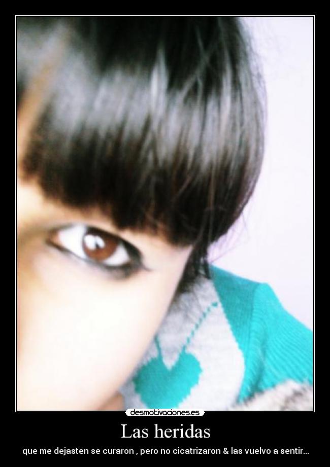 Las heridas -