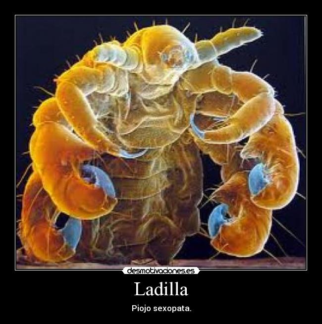 Ladilla -