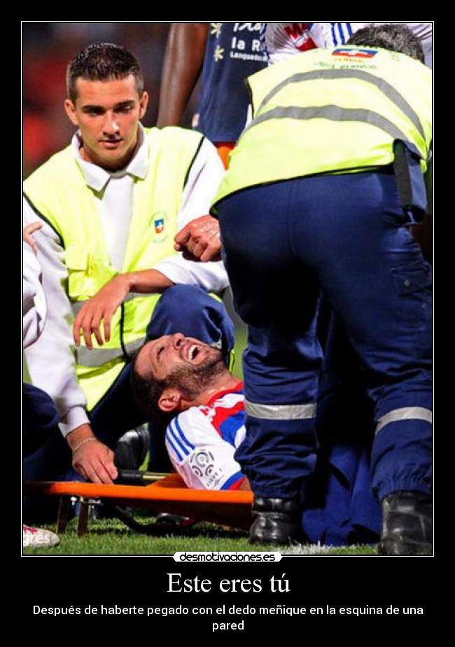Este eres tú - Después de haberte pegado con el dedo meñique en la esquina de una pared